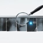 146 Krankheiten aus einem CT-Scan: Alibabas Medizin-KI übertrifft die meisten Radiologen